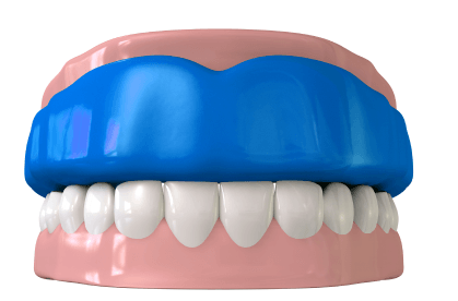 mouth guard