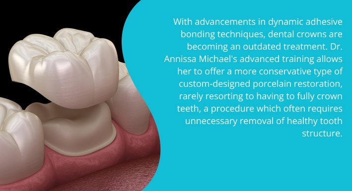 Dental crowns graphic