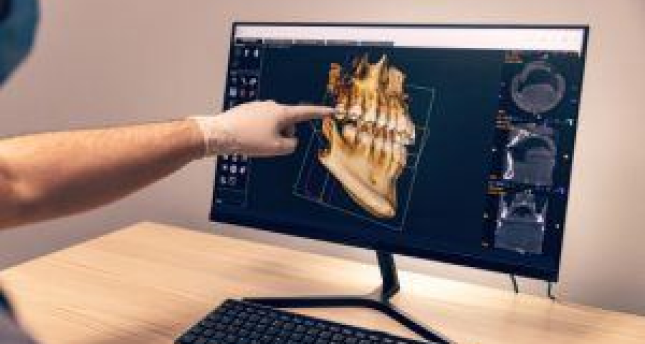 doctor pointing at monitor showing model of mouth